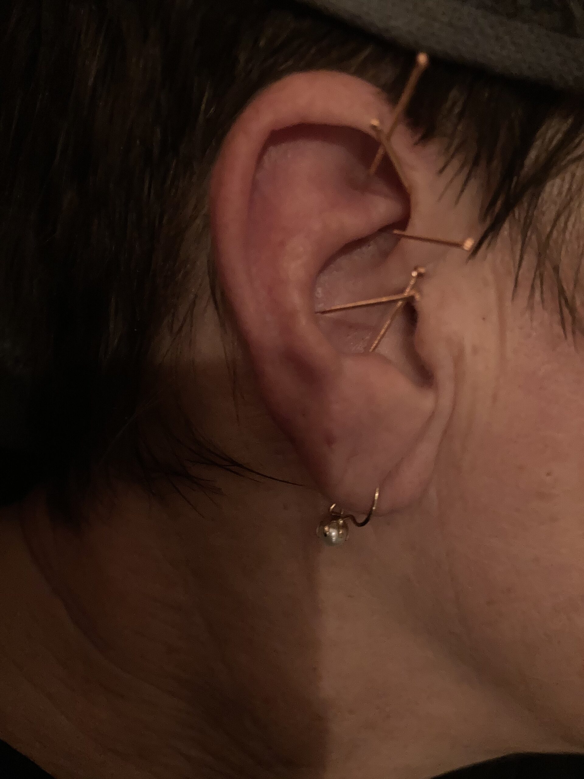 YIN + NADA öronakupunktur 19.3 -26